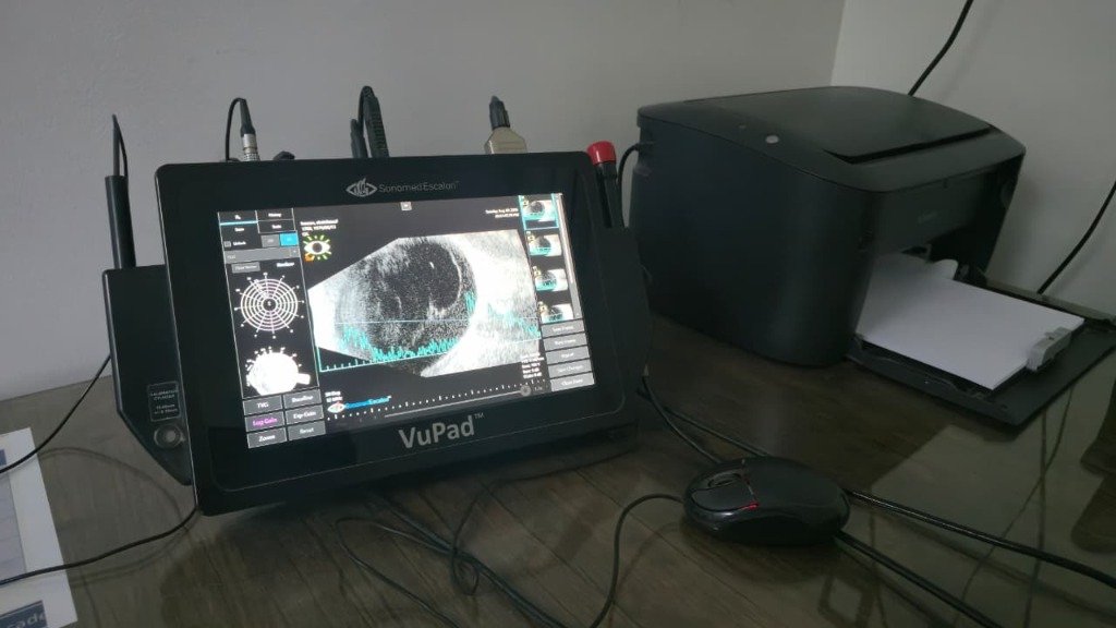 جهاز الموجات الصوتية على العين (VuPad B-Scan)