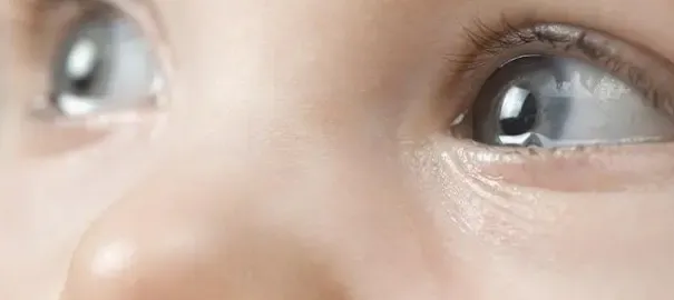 جراحات عيون الأطفال
